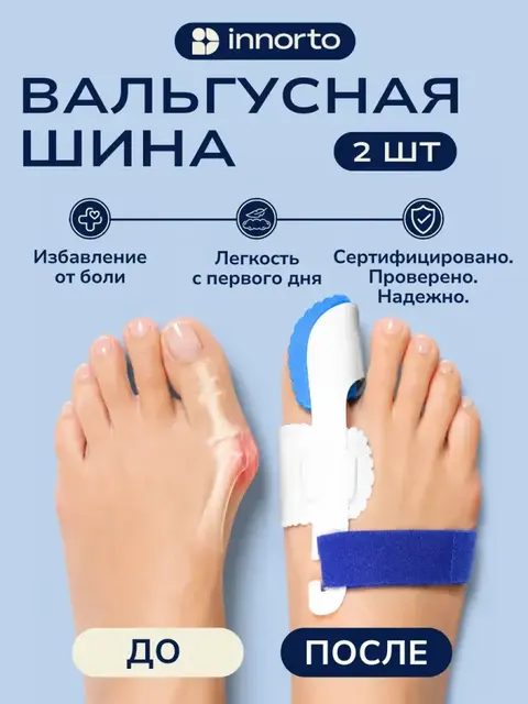 Вальгусная шина для большого пальца ноги