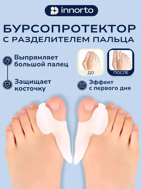 Бурсопротектор для большого пальца