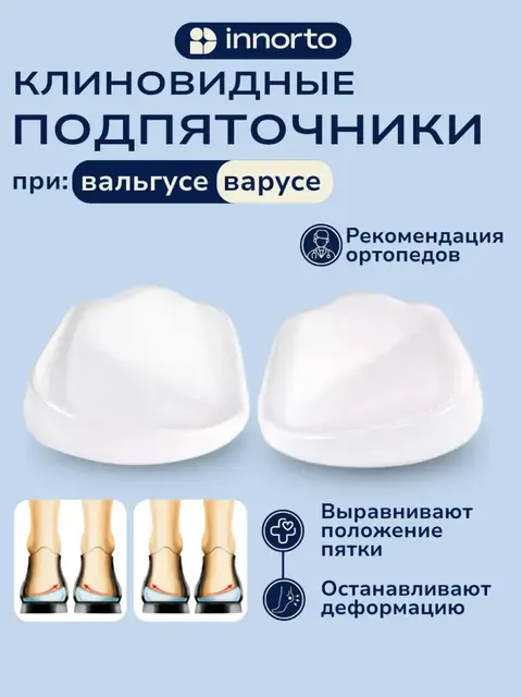 Подпяточник при вальгусной деформации
