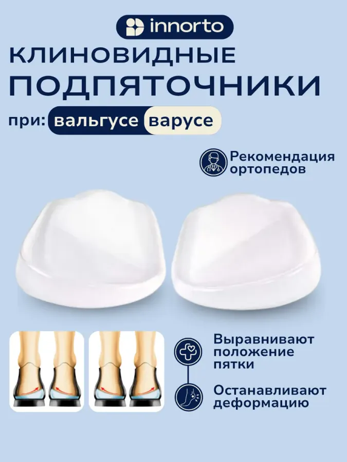Подпяточник при вальгусной деформации