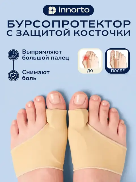 Бурсопротектор для большого пальца