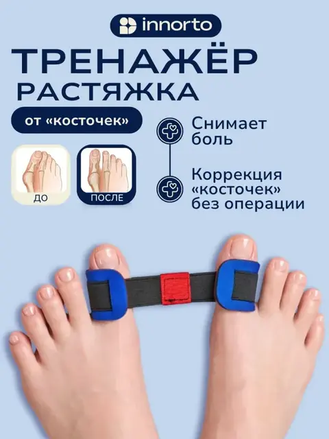 Тренажёр, вальгусный корректор большого пальца