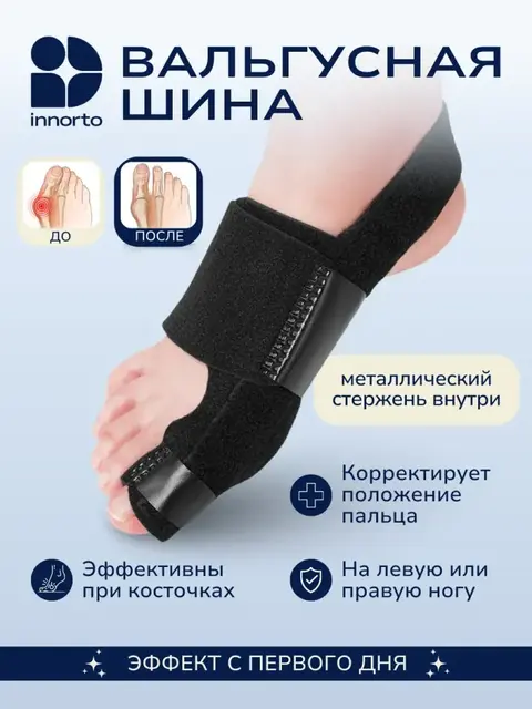 Ортез для вальгусного пальца ноги